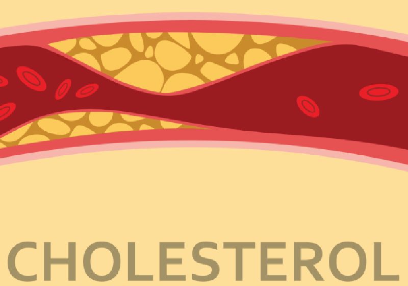 High cholesterol at an early stage of life may lead to death