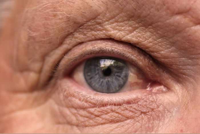 Researchers discover the link between Alzheimer's disease and eye