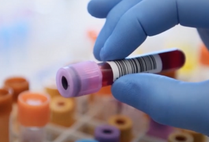 They develop a blood test to predict if you will die in the next 10 years
