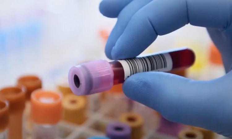 They develop a blood test to predict if you will die in the next 10 years